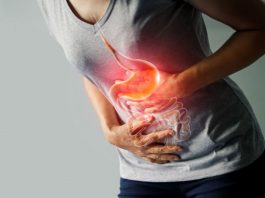 Trào ngược dạ dày
